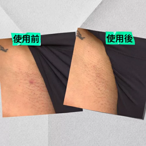 內生毛髮及勻淨膚色精華